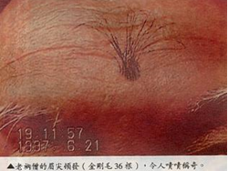 真实佛法在人间 眉间金刚毛大曝光-图片2