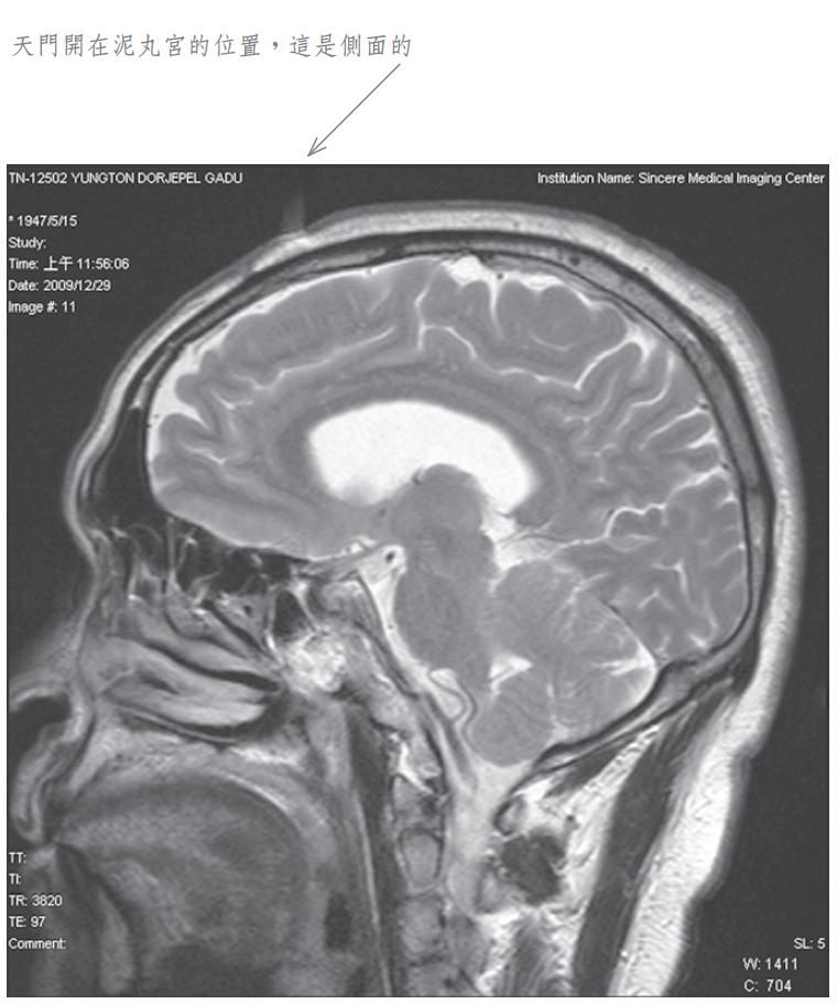 泥丸道果开顶 嘎堵仁波且 成就化身境