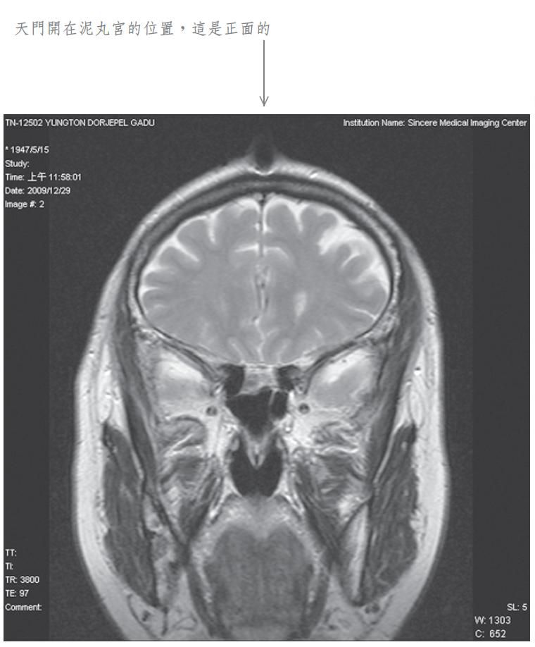 泥丸道果开顶 嘎堵仁波且 成就化身境